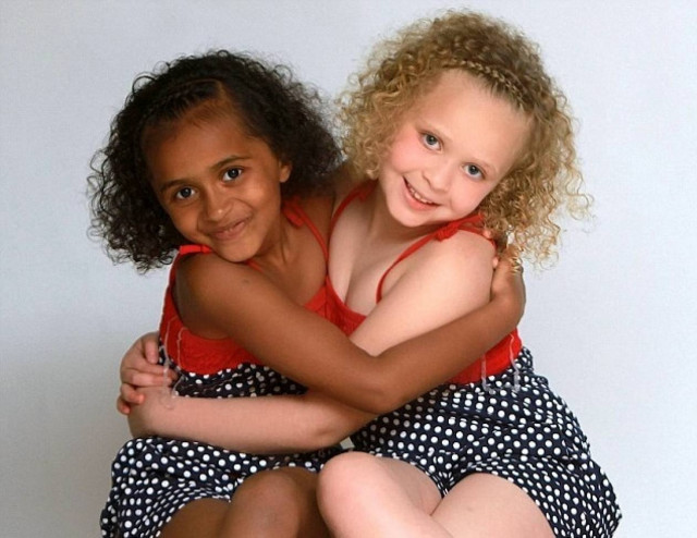 Σπάνια περίπτωση με δίδυμα, η μία λευκή και η άλλη μαύρη