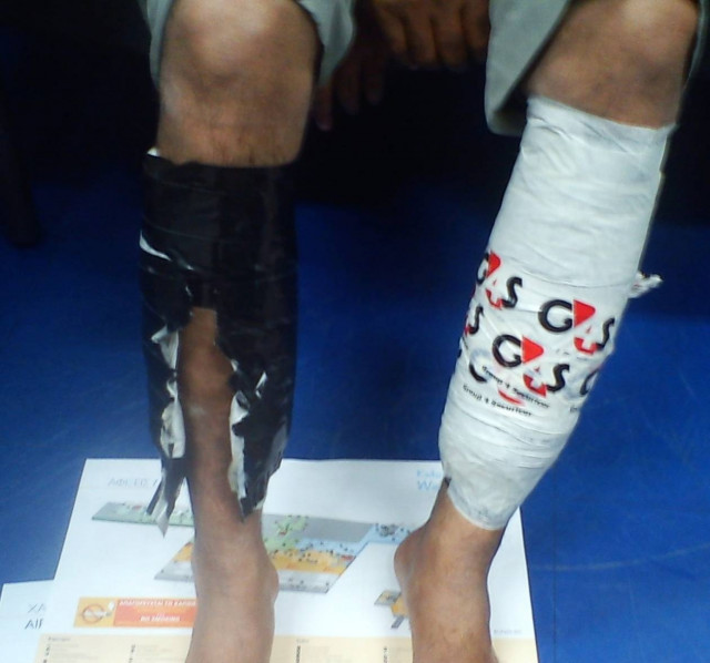 Είχε κρύψει στα ρούχα του 1 κιλό ηρωίνης!