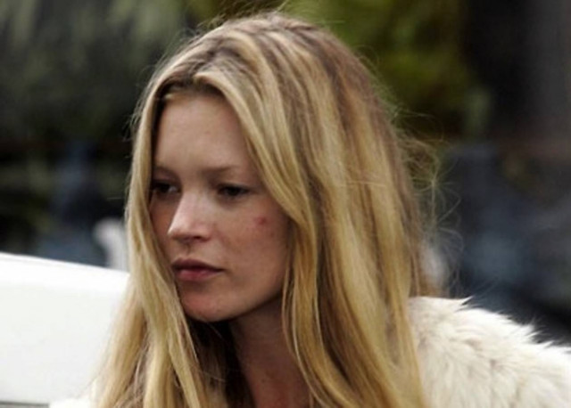 Σταρ με ακμή!