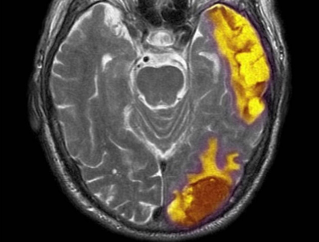 Το «σημείο του Θεού»