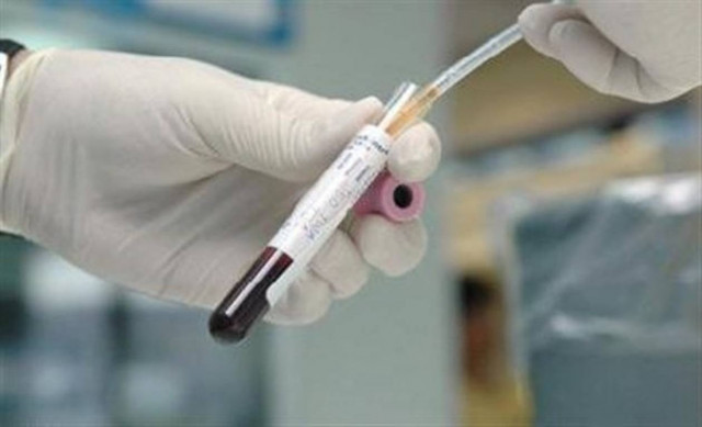 Αναφορά ΙΣΑ στον εισαγγελέα για τα κρούσματα AIDS