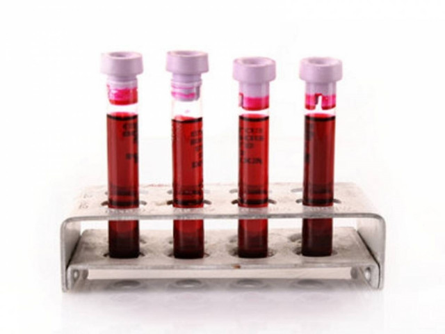 Eξέταση αίματος προβλέπει καρκίνο του μαστού