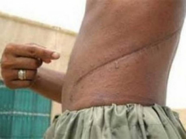 Aνεξέλεγκτο το παράνομο εμπόριο οργάνων