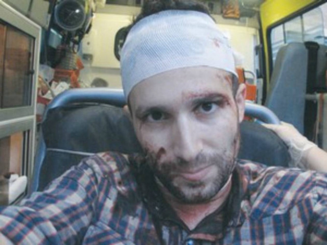 Ξυλοφόρτωσαν ξένο ανταποκριτή που έκανε ρεπορτάζ για την «Χρυσή Αυγή»