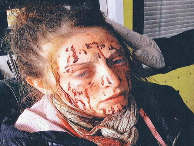 Σοκ: Της επιτέθηκαν στο πλαίσιο «τελετής μύησης» σε συμμορία