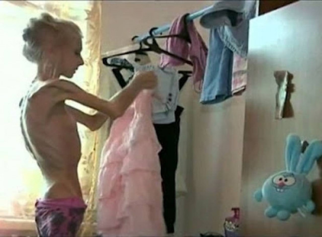 Είναι 20 χρονών και ζυγίζει 20 κιλά