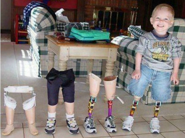 Facebook: Συγκλονίζει η φωτογραφία με πρωταγωνιστή ένα ανάπηρο αγοράκι