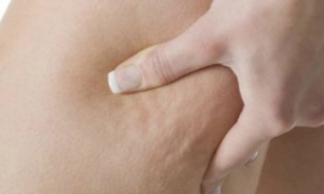 Σταρ γεμάτες... κυτταρίτιδα (pics)