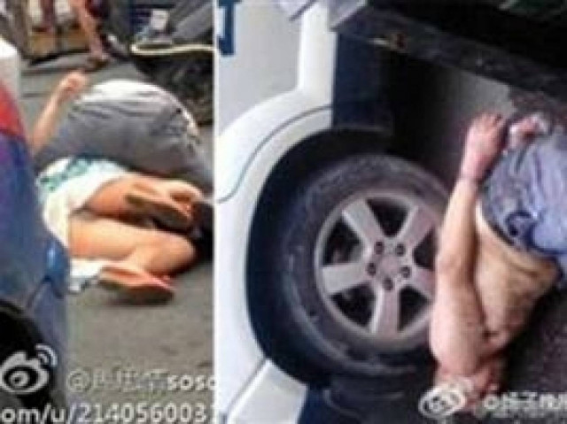 Κανίβαλος έφαγε το πρόσωπο γυναίκας