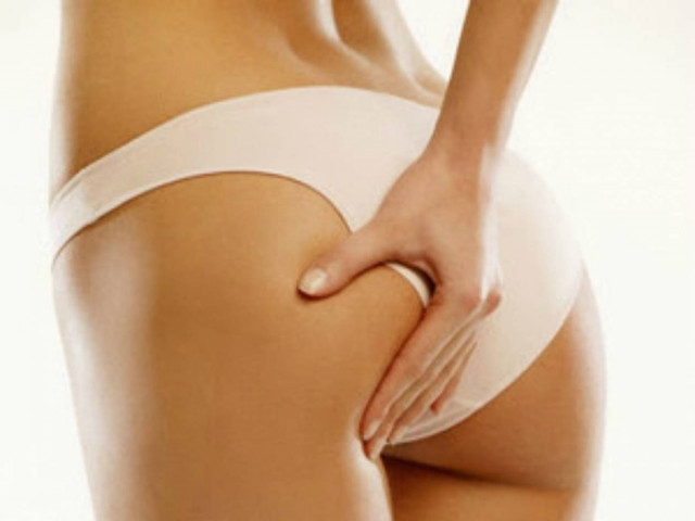 Γιατί οι γυναίκες έχουνε κυτταρίτιδα ενώ οι άντρες όχι;