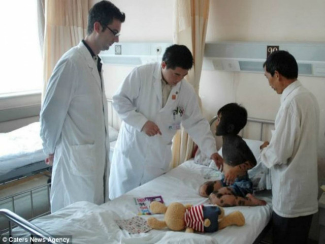 Bρέθηκε θεραπεία για το κοριτσάκι με το πυκνό τρίχωμα