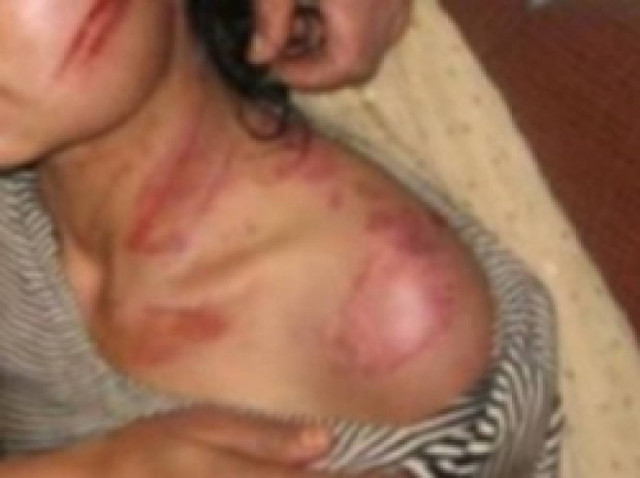 Ηράκλειο: Την πλάκωσε στο ξύλο στη μέση της παραλιακής