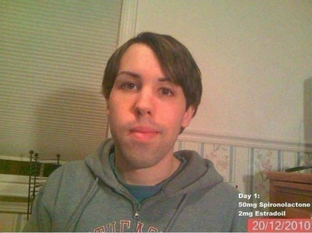 ΔΕΙΤΕ: Τα αποτελέσματα μετά από 14 μήνες οιστρογόνων