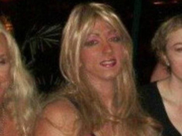 Απίστευτο: Τα φάρμακα για τη φαλάκρα με έκαναν... γυναίκα!