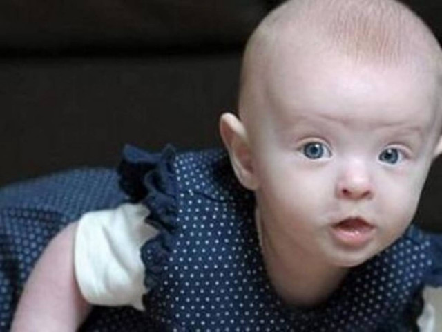 Γεννήθηκε σχεδόν δίχως καθόλου αίμα