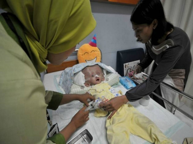 Σοκ: Το κεφάλι της είναι 3 φορές μεγαλύτερο από αυτό ενός ενήλικα