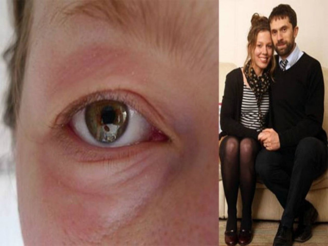 Απίστευτο: Έχει αλλεργία στον... έρωτα