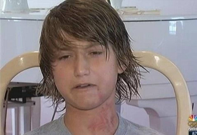 Απίστευτο: Χτυπήθηκε από... περιστέρι!