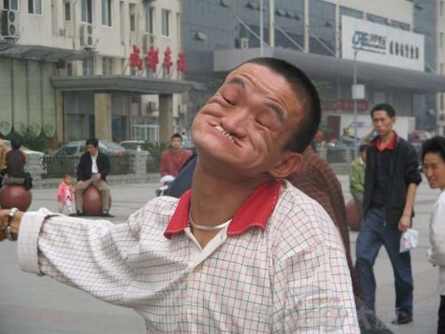 Ο άνθρωπος που μπορεί να δαγκώσει τη μύτη του (pics)