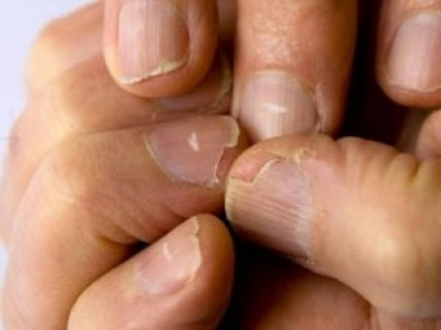 Ποια είναι τα σημάδια και τι δείχνει το καθένα για τον οργανισμό μας;