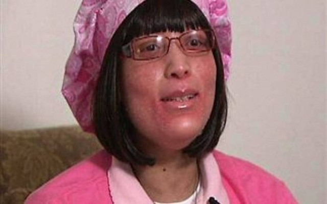 Αντί να βγάζει τρίχες βγάζει νύχια (pics)