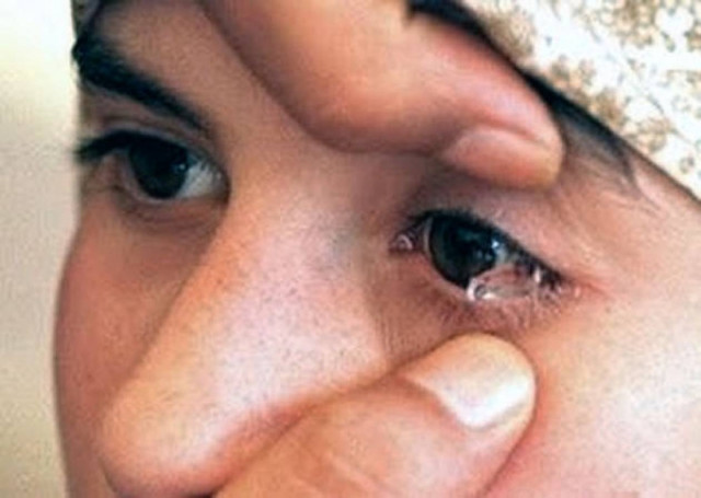 Video: Τα πέτρινα δάκρυα 7χρονης από την Ινδία