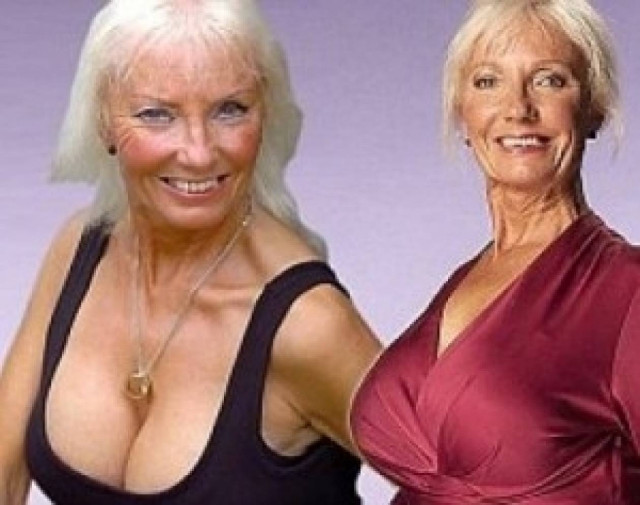 Η 65χρονη που... αύξησε το στήθος της