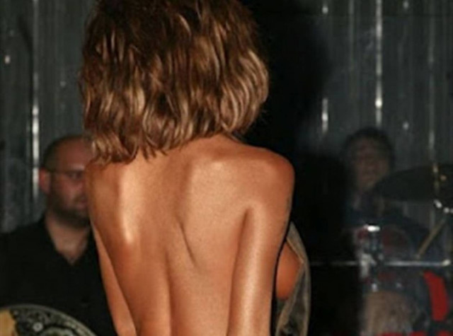 Ποια γνωστή καλλιτέχνης έχει αλλάξει τα πάντα εκτός από το στήθος της;