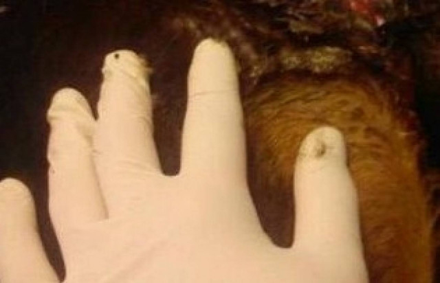 Έβγαλαν την αλυσίδα μέσα από το δέρμα του μετά από 2 χρόνια