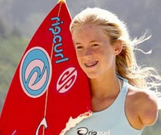 Eπιβίωσε απο επίθεση καρχαρία (pics)