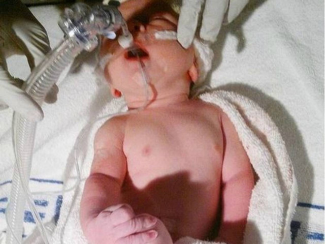 Απίστευτο: Κοριτσάκι ζει με την καρδιά στην δεξιά πλευρά