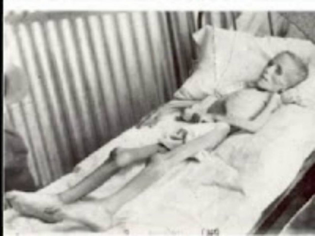 Βίντεο ΣΟΚ - Τα πειραματόζωα του Χίτλερ