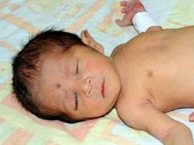 ΔΕΙΤΕ: Παντρεύτηκε τον ξάδελφο της και γέννησε μωρό με 6 πόδια!