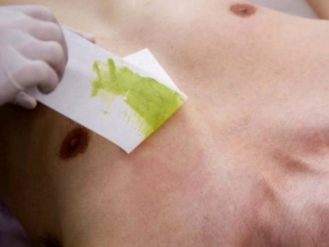 Έλληνας βουλευτής έδωσε 850 ευρώ για ριζική αποτρίχωση!