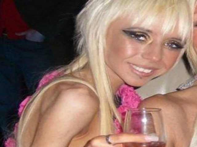 Τα κόκκαλά μου ήταν σαν ξυράφι, λέει μια ανορεξική κοπέλα