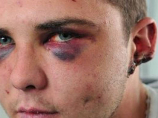 ΕΙΚΟΝΕΣ - ΣΟΚ: Του έκοψαν κομμάτι από το αυτί με δαγκωματιά