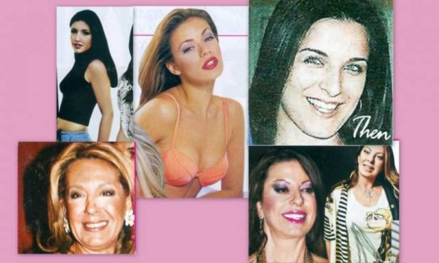Δείτε το πριν και το μετά των Ελληνίδων που έκαναν πλαστική