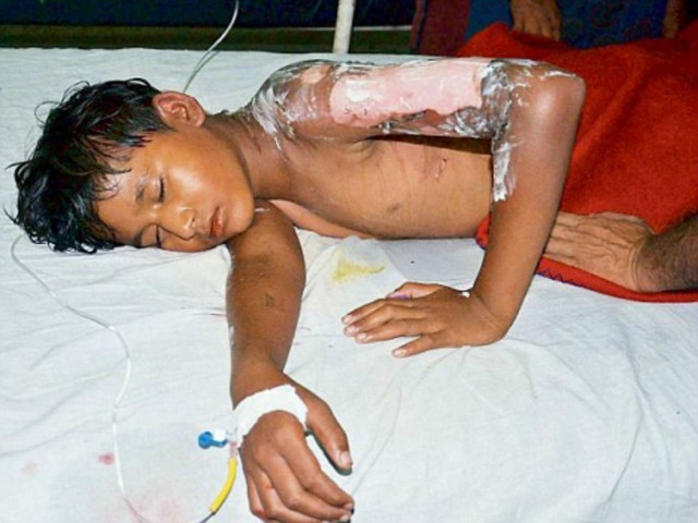 Έριξε τον 12χρονο μέσα σε καζάνι με βρασμένο γάλα!