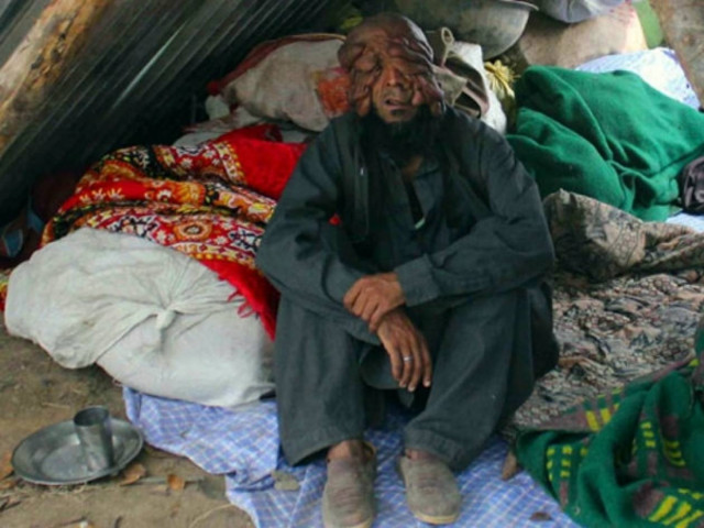 ΣΟΚ: Ο άνθρωπος χωρίς πρόσωπο (σκληρές εικόνες)