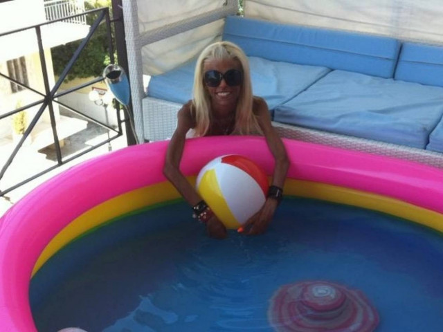 Ν.Καραγιάννη: Όλη η αλήθεια για το πρόβλημά της με τη νευρική ανορεξία