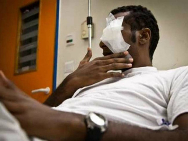 ΣΟΚ: Τον άφησαν σχεδόν τυφλό επειδή ήταν μελαμψός!