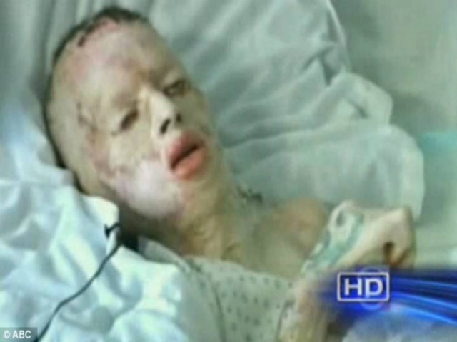 Σοκ: Κατονόμασε τον άνθρωπο που τον βίασε και του έβαλε φωτιά!