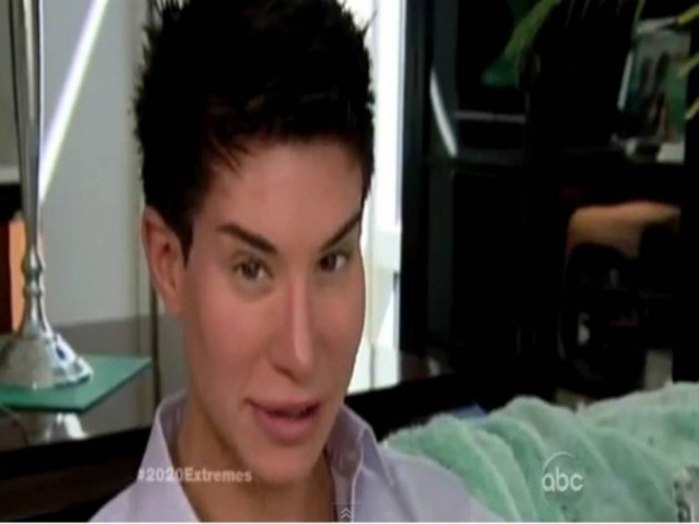 Βίντεο-σοκ: Ο άνδρας που ήθελε να μοιάσει σε πλαστική κούκλα!