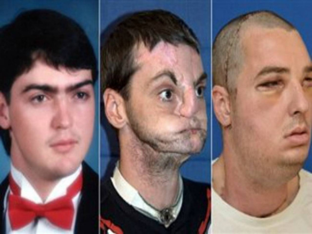 Ο άνθρωπος χωρίς πρόσωπο μπορεί και πάλι να κυκλοφορήσει έξω!