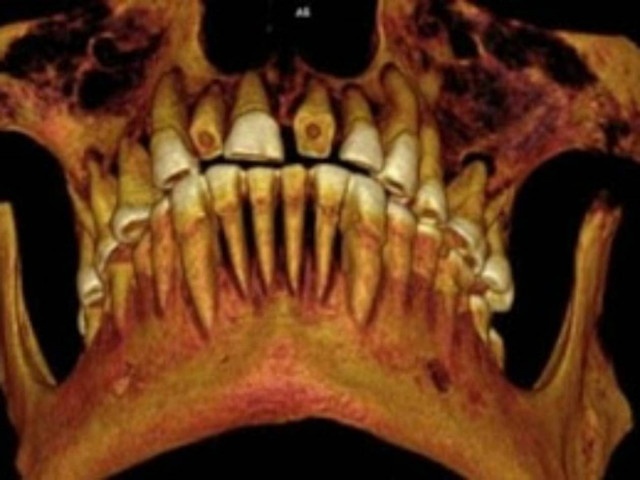 Το χειρότερο περιστατικό στην ιστορία της οδοντιατρικής