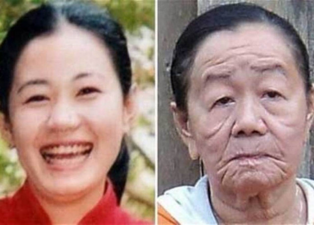 Εικοσιεξάχρονη γέρασε μέσα σε λίγες ημέρες λόγω αλλεργίας