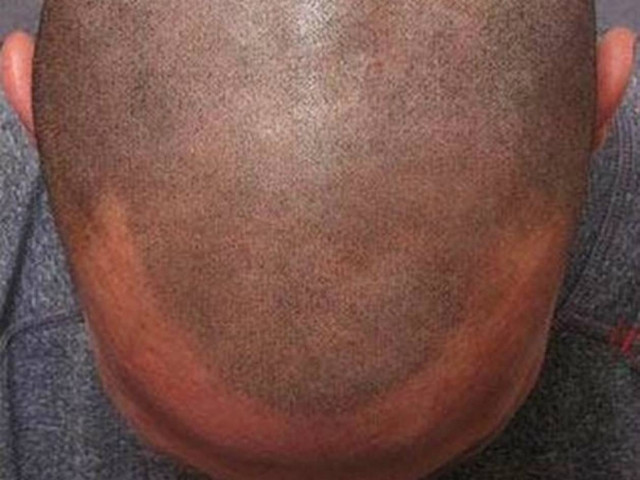 Κάνουν τατουάζ... μαλλιά! (pics)