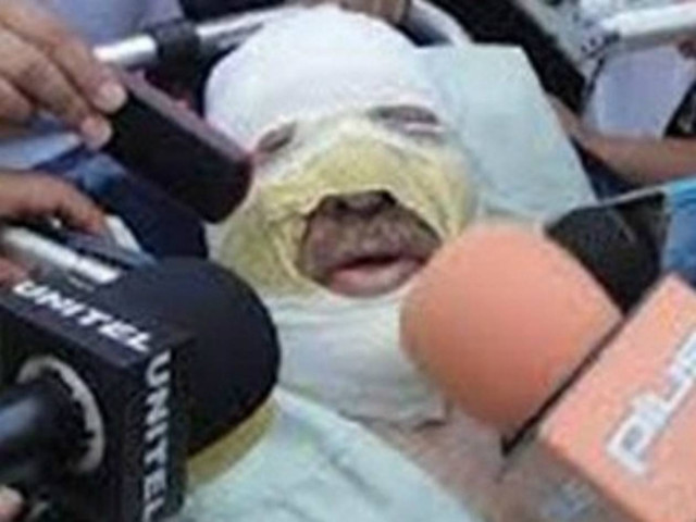 Επιχείρησαν να κάψουν ζωντανό ιδιοκτήτη ραδιοφωνικού σταθμού