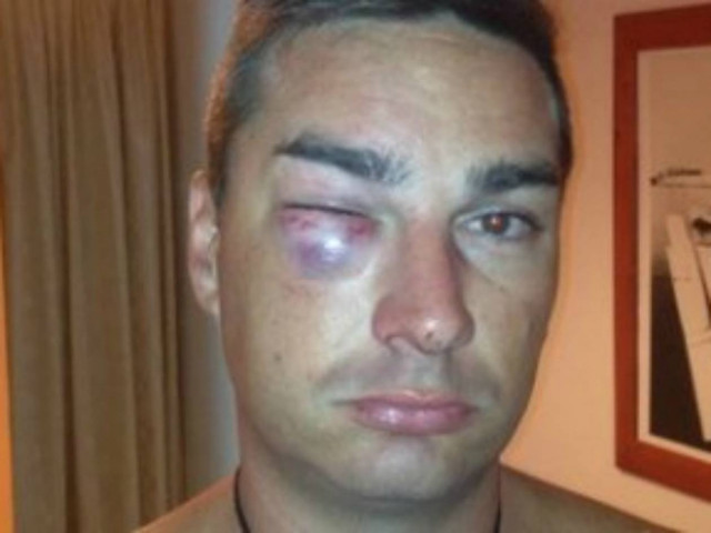 Καταγγελία τουρίστα:«Με λήστεψαν και με χτύπησαν αστυνομικοί»