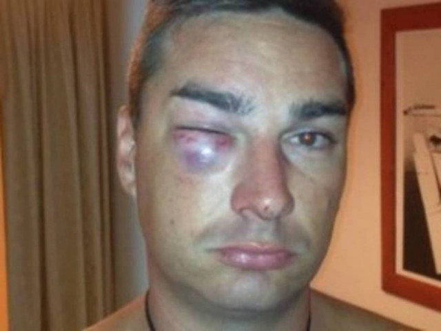 Η ΕΛ.ΑΣ. απαντά στις κατηγορίες τουρίστα για ξυλαδαρμό